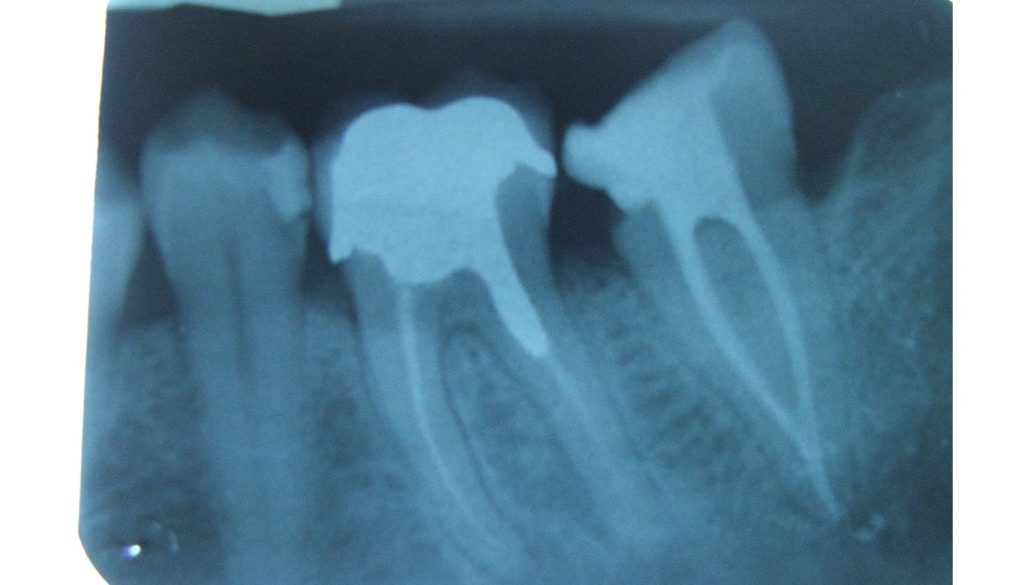 endodonzia1