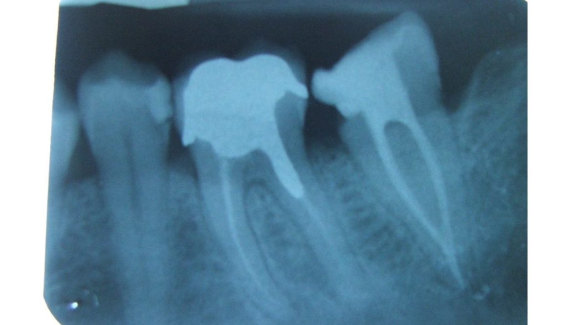endodonzia1