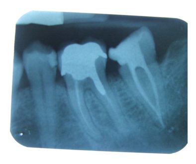 endodonzia1